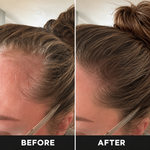DualGlow - Advanced LED Hair Growth Cap With Red Light Therapy