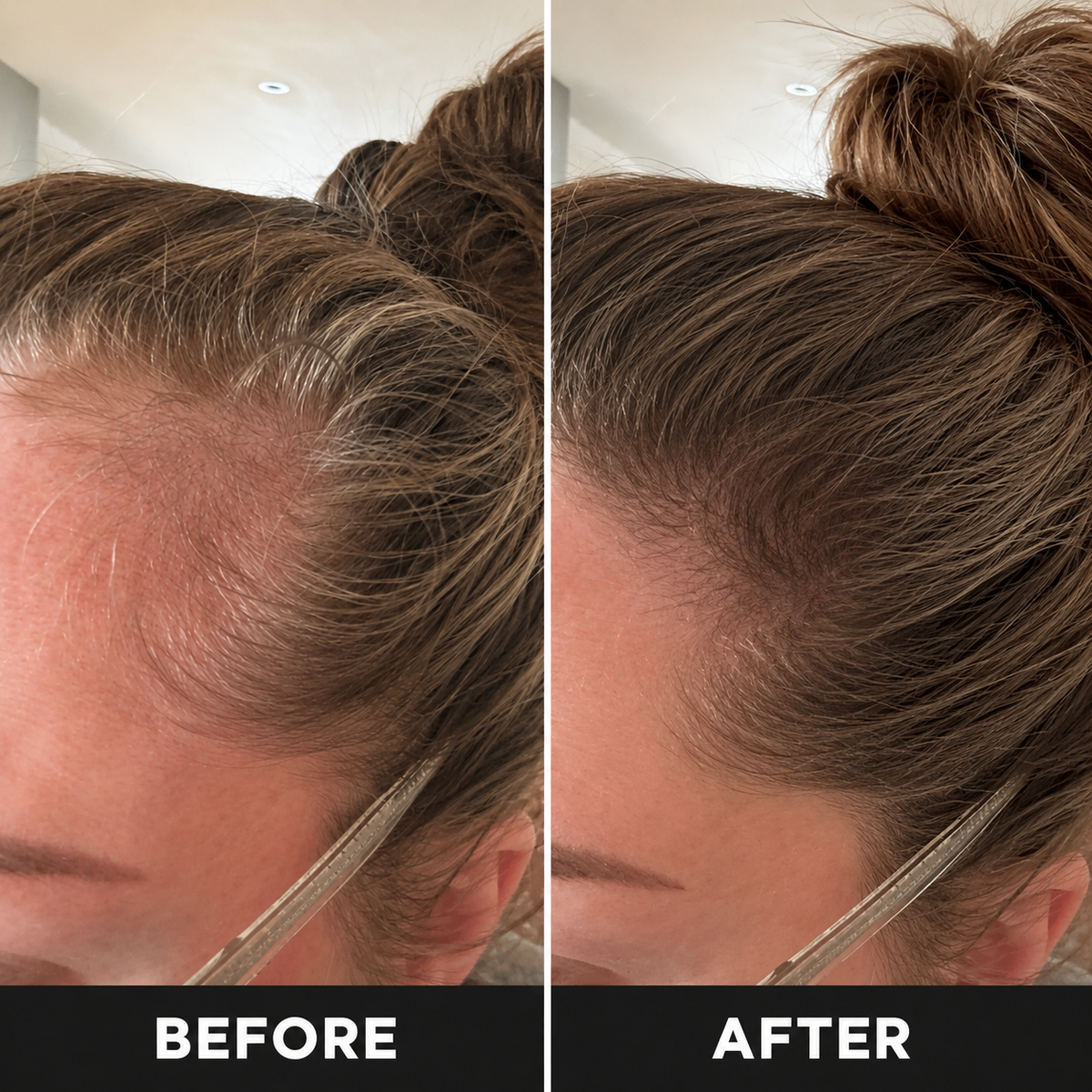 DualGlow - Advanced LED Hair Growth Cap With Red Light Therapy