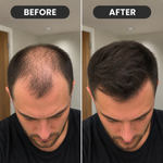 DualGlow - Advanced LED Hair Growth Cap With Red Light Therapy